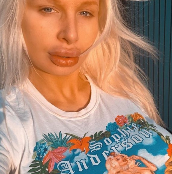 一年感染4次!英國女優「假球」炸裂 掀衣痛哭求救:請幫幫我