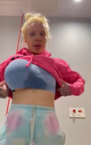 一年感染4次!英國女優「假球」炸裂 掀衣痛哭求救:請幫幫我