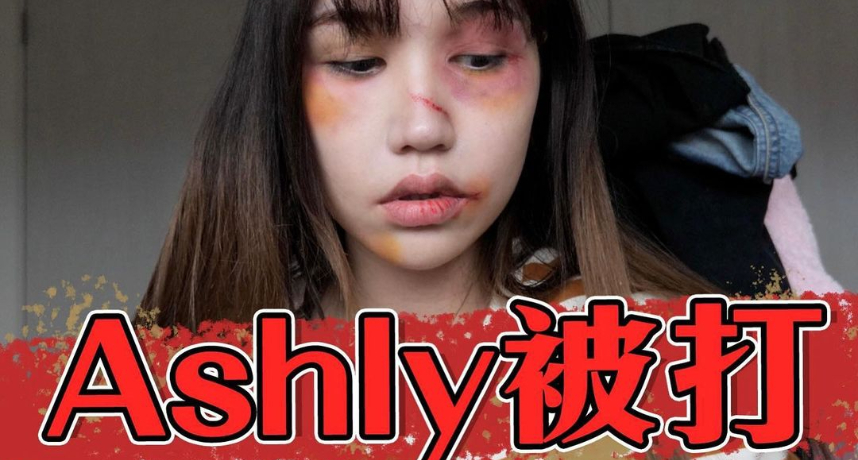 Ashly遭尼克家暴？「全臉烏青」畫面流出　網：要打113！