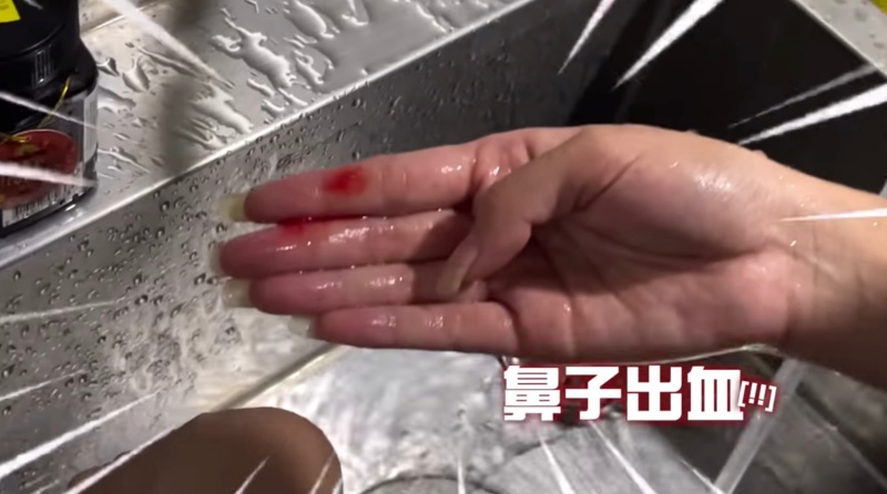 吐到流鼻血!百萬網紅懷孕「無力攤地尿失禁」 辛苦畫面全曝光