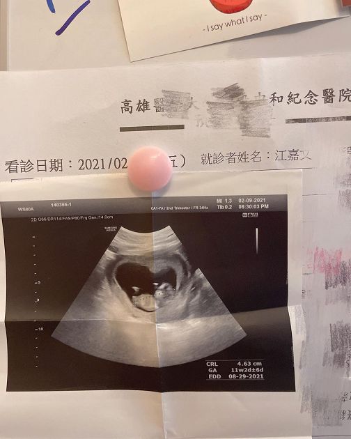 變性三年「宣布懷孕」!罔腰甜曬超音波 網嚇壞:醫學奇蹟?