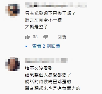 遭疑整形!美麗妄娜「嘴歪」畫面曝光 網:臉型很奇怪