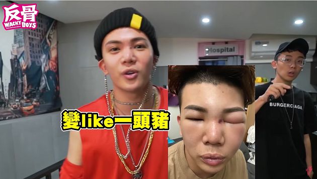 腫成豬頭!孫生爆「險毀容原因」 示愛前女友:林襄上有我記號