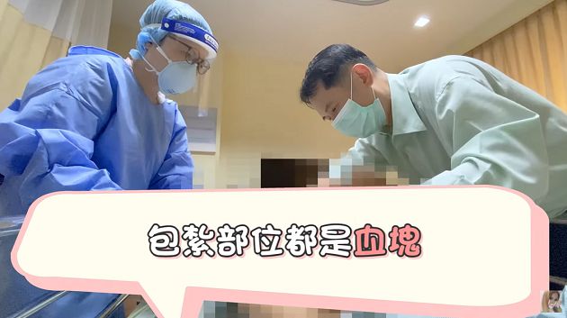 下半身插滿管!小A辣「變性手術」畫面曝 拆線哀嚎紗布全是血