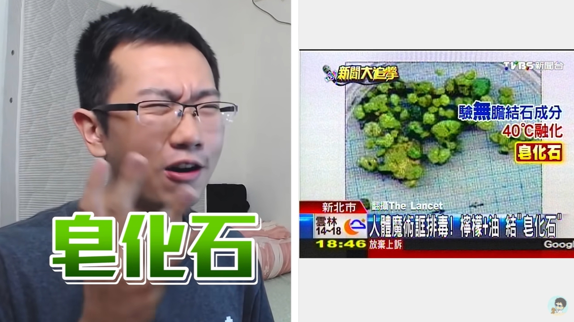 喝橄欖油排膽結石!台大醫打臉「愛莉莎莎」:真的太糟糕