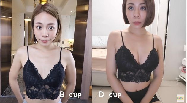 正妹網紅「自爆隆乳」!公開手術過程「B→D」:胸部長出來了!