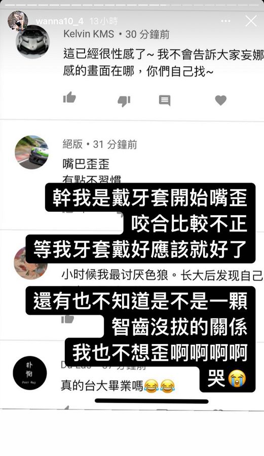 遭疑整形!美麗妄娜「嘴歪」畫面曝光 網:臉型很奇怪