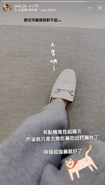 臉腫兩倍大!大胃王路路自爆「蜂窩性組織炎」:吃出抗藥性