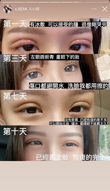 誠意兇照回歸!青青消失IG近況曝光 網揪「不一樣」:整形了?
