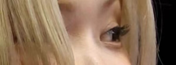 戴墨鏡擋恢復期?Rosé雙眼皮加寬「遭疑偷動刀」網曬特寫回擊:沒看過雙眼皮貼?
