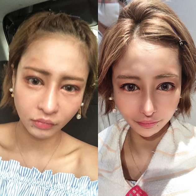 狂噴580萬!日本第一紅牌「真面目曝光」:接下來想變成橋本環奈