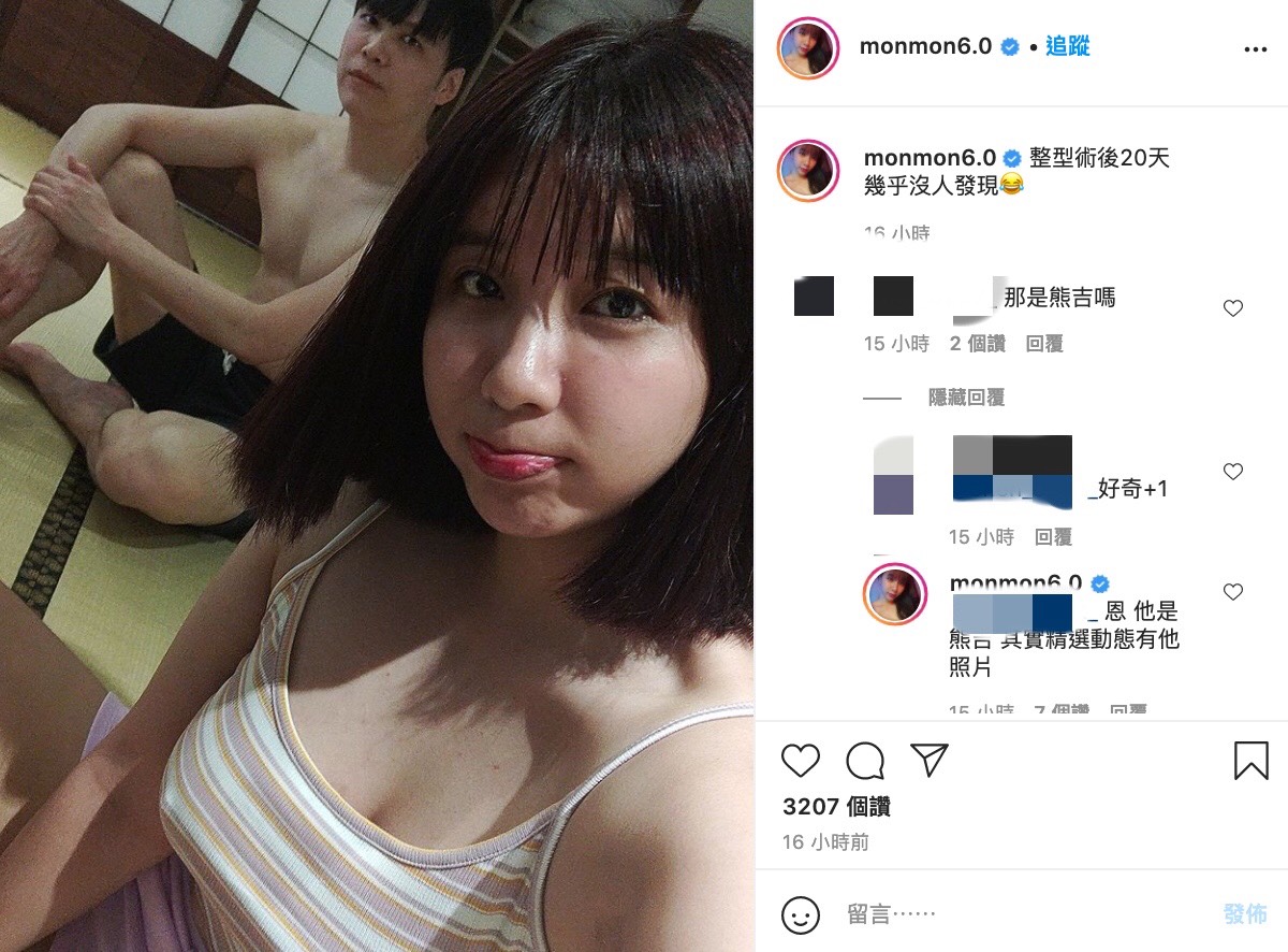 吳夢夢昨日曬出一張性感自拍照,而大名鼎鼎的男友「熊吉」也罕見與她同框合照,吳夢夢表示自己整形至今已有20天了,但卻沒有被任何人發現。只見照片中夢夢疑似素顏入鏡,但五官看起來卻相當自然,看不太出來有動過刀的痕跡。 面對網友的提問,吳夢夢相當坦然表示自己這次的整形項目是無痕提「眼肌」以及「上唇」。此外她更大方透露其實自己從18歲就開始整形了,累積至今12年已經花了超過100萬。 她表示22歲那年第一次墊下巴花了10萬元,2年後又把假體抽出做正顎矯正花了40萬元。接著同年開始踏上了「抽脂」之路,每年都要進行1至2次,單是金額花費大約15萬元,加上此次的整形項目,網友粗估可能金額已進200萬元,相當可觀。 夢夢也透露身上目前有20到30個抽脂留下的疤痕,可見為了愛美也付出了不小的代價。今日她更久違開放IG問答,有粉絲因此好奇提問夢夢有關減肥的問題:「是不是很想得到夢寐以求的窈窕身材,還是為了要養足觀眾的慾望」。 夢夢則回想起了五年前體重只有52公斤的時候:「那年我過得超糟的」、「如果瘦回去的代價,是像當年一樣一無所有,每天情緒崩潰,無時無刻在想自我了斷,對食物無感,甚至厭惡」、「那我寧可像現在這樣就好」,樂觀的態度也讓粉絲相當開心,紛紛鼓勵她:「喜歡你現在的樣子,過得快樂最重要」、「不管你變得怎麼樣,喜歡你的人依然會永遠支持你」、「加油,不用管酸民意見,做自己最重要」。