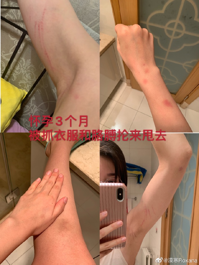 圖片來源/張漠寒微博