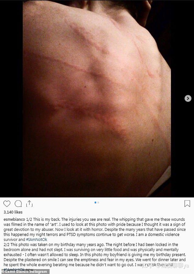 艾斯米比安科
