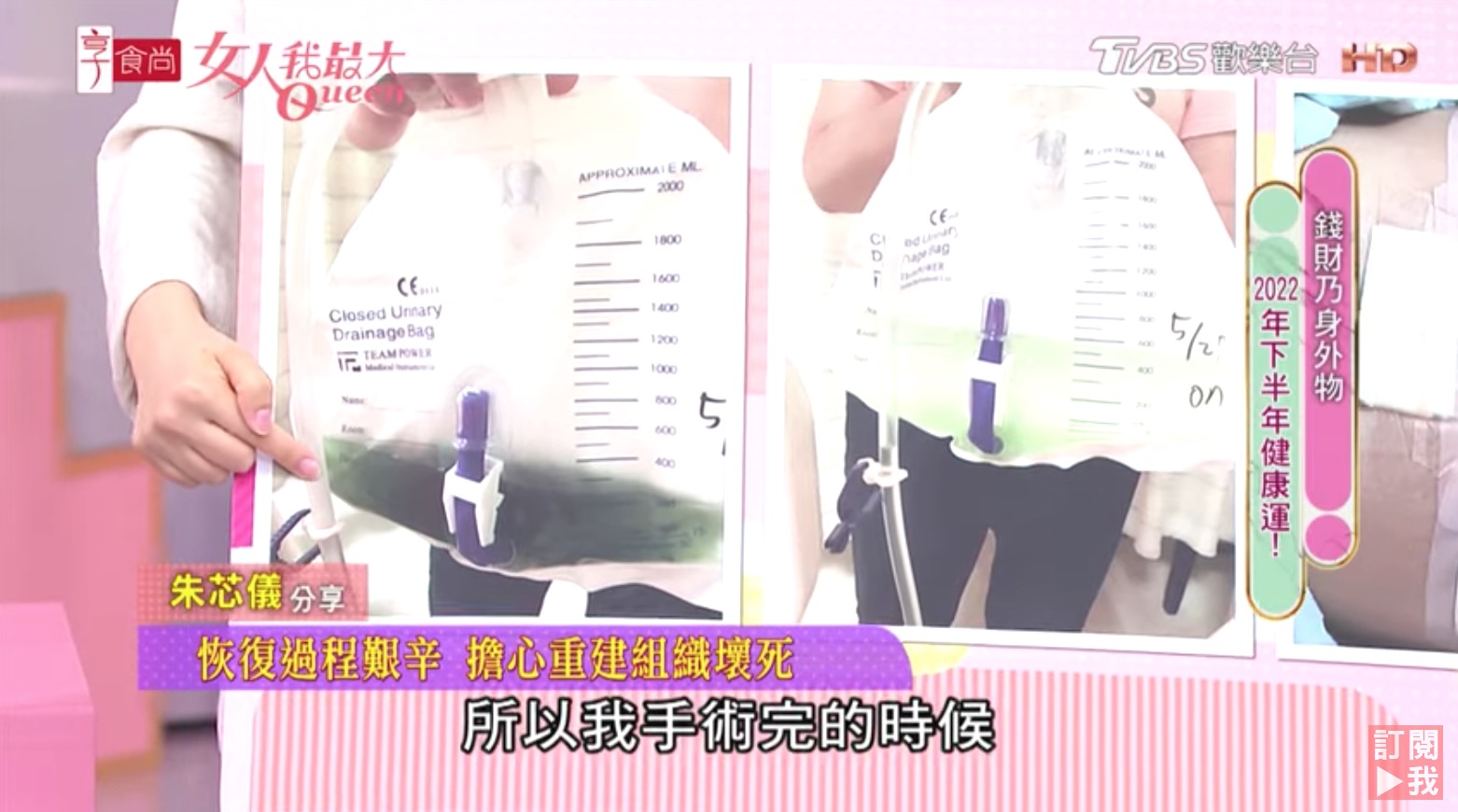 朱芯儀手術未完!「切肚皮重建乳房」捨棄2重要部位:現在還是麻的