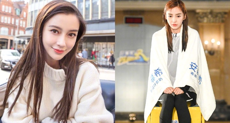 「Angelababy」受傷緊急送醫！「傷勢照曝光」遭酸民冷嗆：故意露給人看？