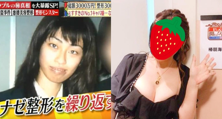 親媽從小嫌「長得很醜」！女模動刀300次　「變整形怪物」術後真人曝光！