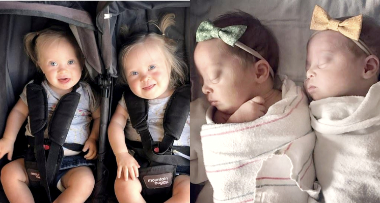 不顧醫生「苦勸流產」！媽媽堅持生下「唐寶寶雙胞胎」…感性曝：是非常幸運的事！