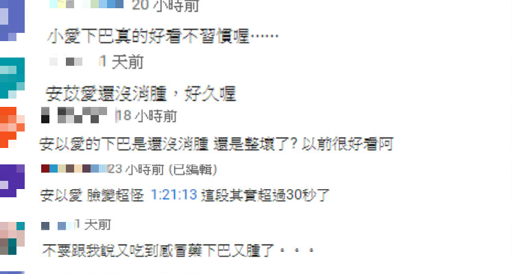 整形失敗？「安苡愛」下巴詭異「腫大、僵硬」　網傻眼：瞬間老10歲！