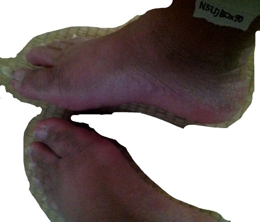 7年沒洗過澡!悶房全身冒黑垢 日男宣布「剪留2年指甲」 照片公開全網崩潰!