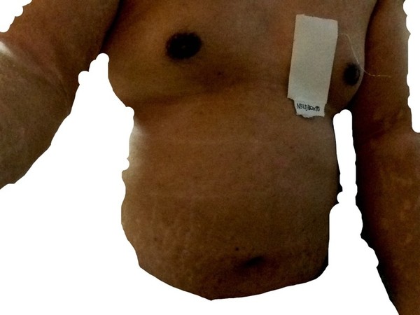 7年沒洗過澡!悶房全身冒黑垢 日男宣布「剪留2年指甲」 照片公開全網崩潰!