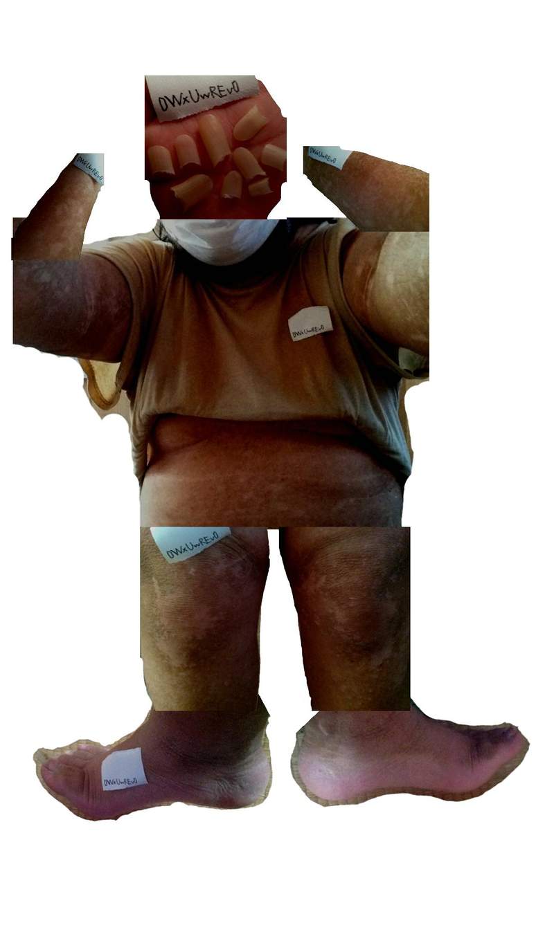 7年沒洗過澡!悶房全身冒黑垢 日男宣布「剪留2年指甲」 照片公開全網崩潰!