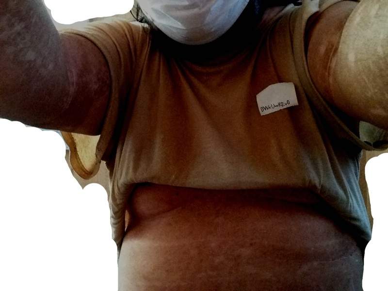 7年沒洗過澡!悶房全身冒黑垢 日男宣布「剪留2年指甲」 照片公開全網崩潰!