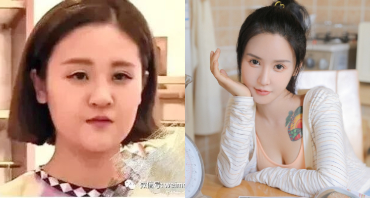 蛇精男「劉梓晨」怒譙「百萬網紅」：越整越醜！「照片曝光」網酸爆：五十步笑百步！