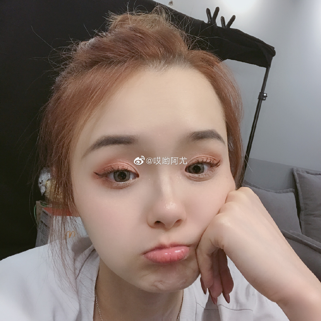 生命不值錢?大胃王吃腐爛物 「身體異常」網急:多處潰爛