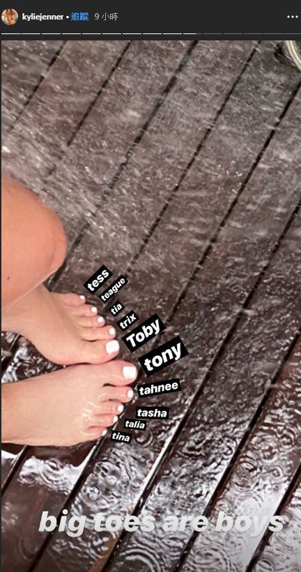 右腳指頭「只剩一丁點」！億萬女富豪挨轟P圖過頭：意外曝舊疾