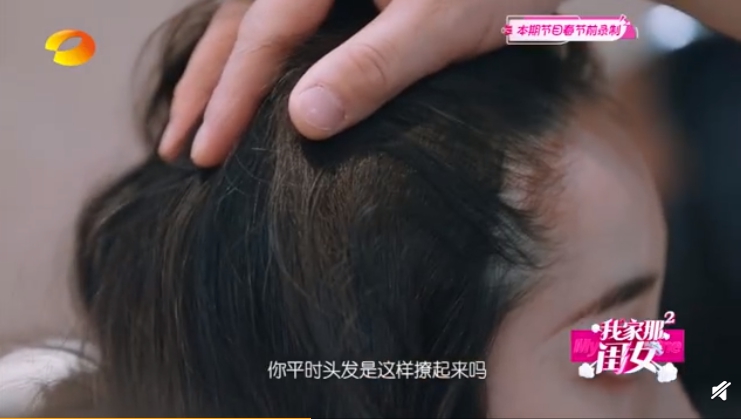 壓力太大要植髮?女星自曝「禿頭煩惱」 當眾拆假髮嚇壞網