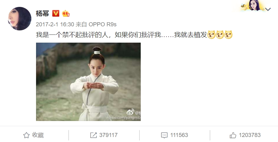 壓力太大要植髮?女星自曝「禿頭煩惱」 當眾拆假髮嚇壞網