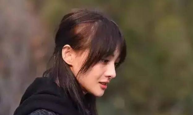 壓力太大要植髮?女星自曝「禿頭煩惱」 當眾拆假髮嚇壞網