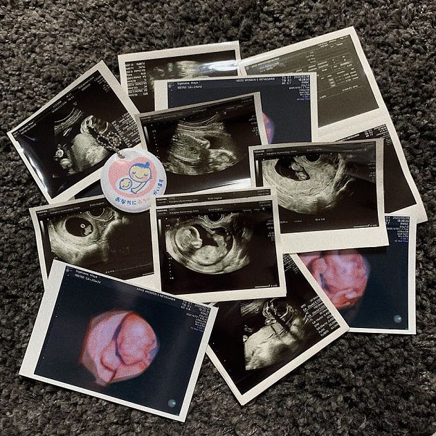 最萌女高中生宣布懷孕！「配對節目認識」：在一起一年多了～