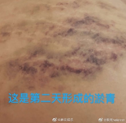 男星「變態性癖好曝光」!前女友控訴「遭逼虐待過程」:他叫我舔馬桶