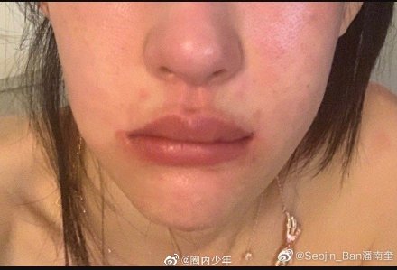 曾遭爆「花十億整形」!八頭身兇妹「被打成豬頭」崩潰:已經一年了!