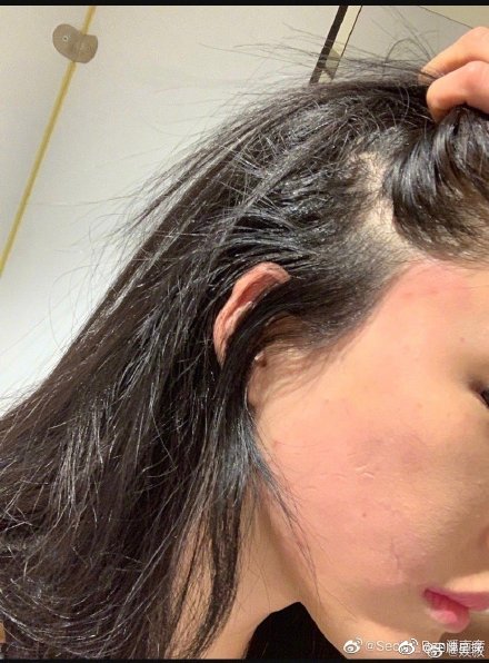 曾遭爆「花十億整形」!八頭身兇妹「被打成豬頭」崩潰:已經一年了!