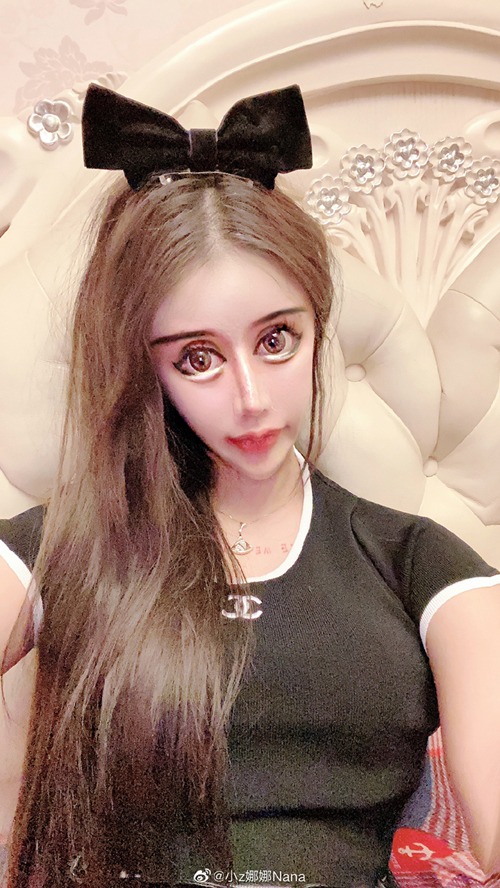 3年整形100次!超兇網紅公開「超狂進化史」 網全崩潰:沒整根本是仙女