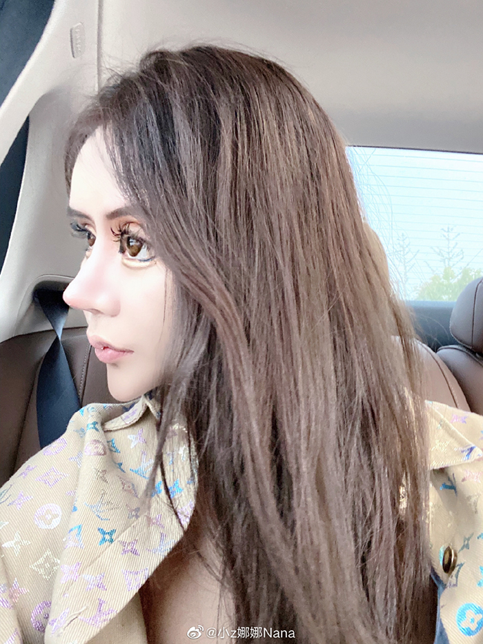 3年整形100次!超兇網紅公開「超狂進化史」 網全崩潰:沒整根本是仙女