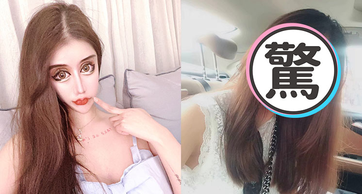 3年整形100次！超兇網紅公開「超狂進化史」　網全崩潰：沒整根本是仙女