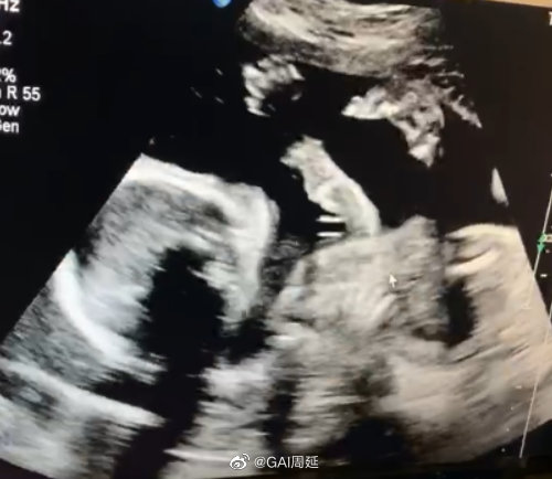 《有嘻哈》GAI當爸!「老婆正面孕照曝光」 網:和Jony J一起賺奶粉錢