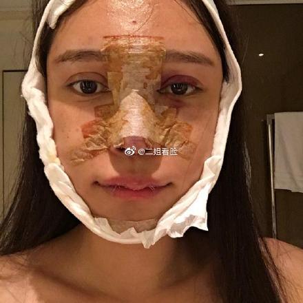 14歲就進廠！超兇網紅「16年整形100次」　「術後照曝光」嚇歪網！