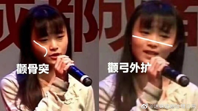 全身都假的?「中國第一美女」整容史再起底 網怒:滿嘴謊話