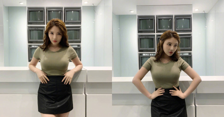 為戲拆兩根肋骨?E奶美模嚇壞 PO照闢謠:水通腰大象腿還在