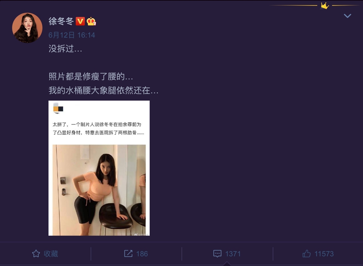 為戲拆兩根肋骨?E奶美模嚇壞 PO照闢謠:水通腰大象腿還在