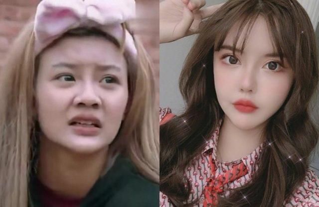 爆第35次動刀！百萬網紅「驚悚術後照」曝光　網傻眼：活到老整到老