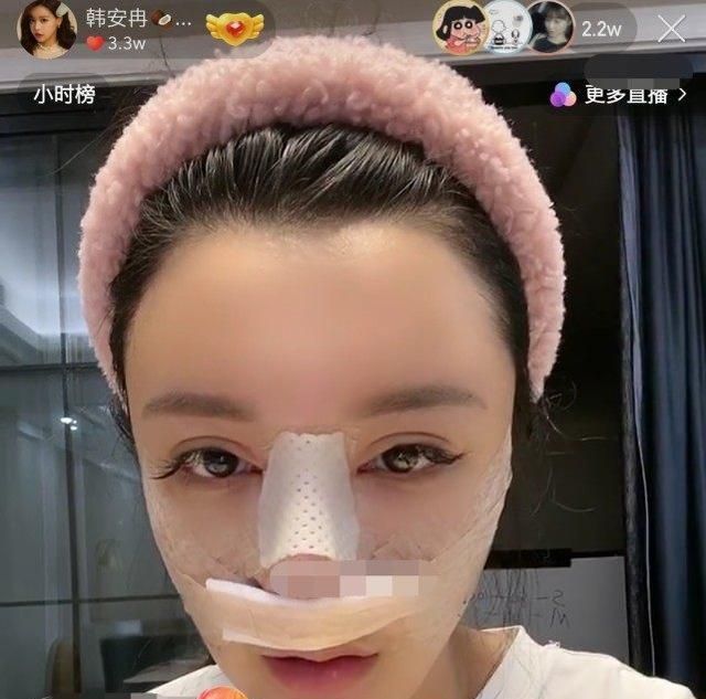 爆第35次動刀！百萬網紅「驚悚術後照」曝光　網傻眼：活到老整到老