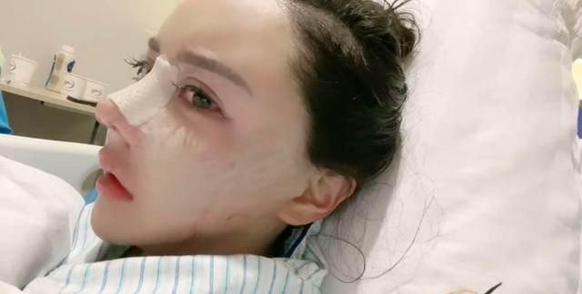 爆第35次動刀！百萬網紅「驚悚術後照」曝光　網傻眼：活到老整到老