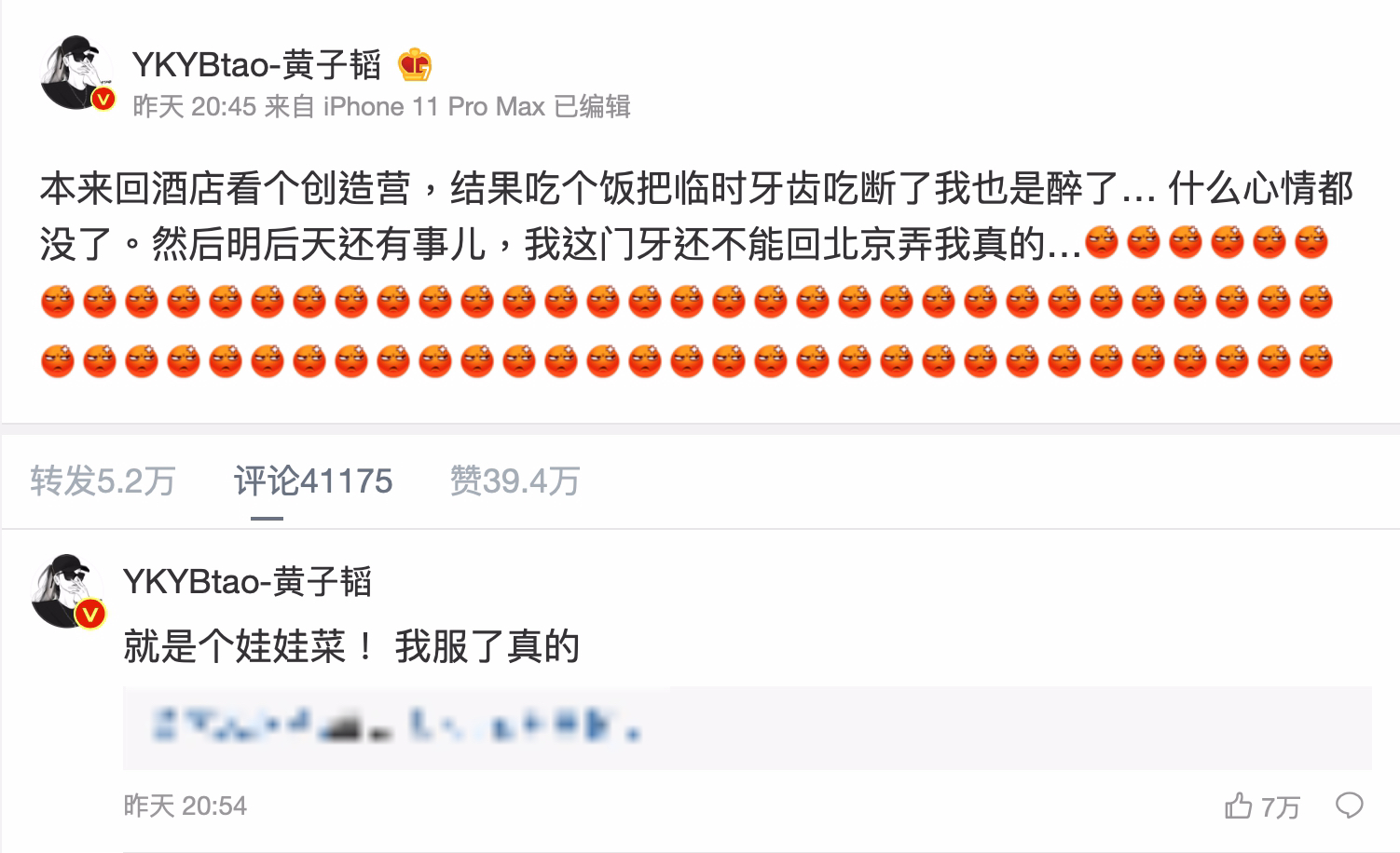 吃飯吃到門牙斷!黃子韜怒揭「破相兇手」 網見真相笑翻