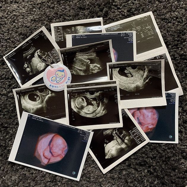 日本最正高中生結婚了！認識1年多「宣布懷孕」：孕肚曝光